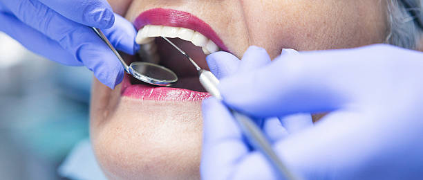 Best Broken or Chipped Tooth Repair in Trevose, PA